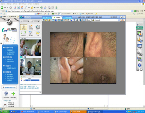 원격화상진료서비스로 병 치료